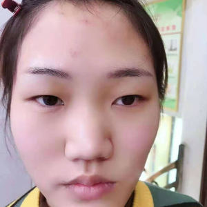 整形前后对比图片