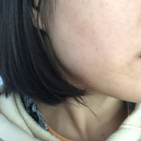 嫩肤社用户图片