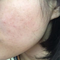 嫩肤社用户图片