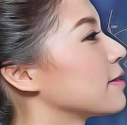 玉林視力矯正手術(shù)哪個(gè)醫(yī)院好