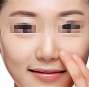 撫州公立眼科醫(yī)院做近視手術(shù)多少錢
