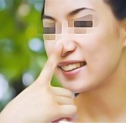 鄂爾多斯百悅醫(yī)療美容診所怎么樣