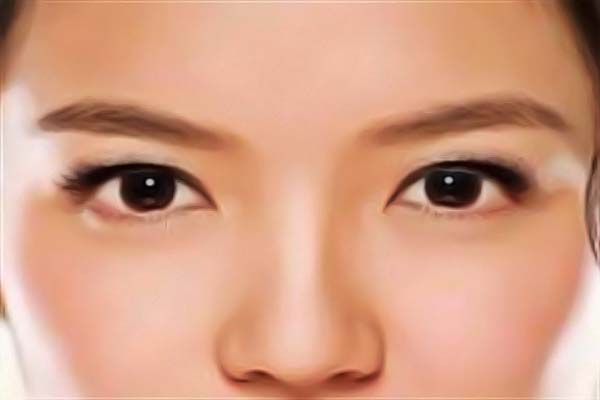 北京哪家整形医院做面部拉皮手术效果较佳？