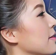 鄂爾多斯天王醫(yī)學(xué)美容醫(yī)院口碑評價
