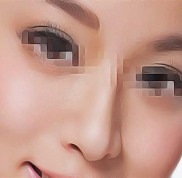 蘭州眼科醫(yī)院哪家口碑好