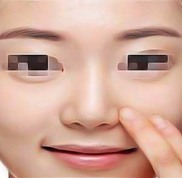 新鄉(xiāng)視力矯正手術(shù)哪家口碑好