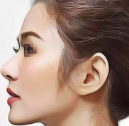 運城迅美醫(yī)療美容門診部口碑評價