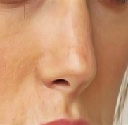 寧波顏植術(shù)醫(yī)療美容診所怎么樣