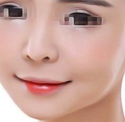咸寧甜心醫(yī)生醫(yī)療美容門診部怎么樣