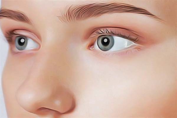 苏州医院近视眼手术有哪些优势？