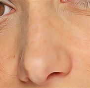 杭州眼科醫(yī)院哪個(gè)好