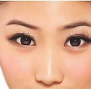 宜賓視力矯正手術(shù)哪個(gè)醫(yī)院好