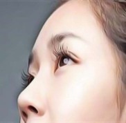濰坊星坊醫(yī)療美容醫(yī)院好不好