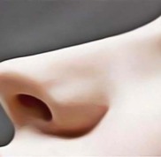 威海視力矯正手術(shù)價格多少錢