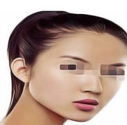 岳陽眼科醫(yī)院哪個(gè)醫(yī)院好